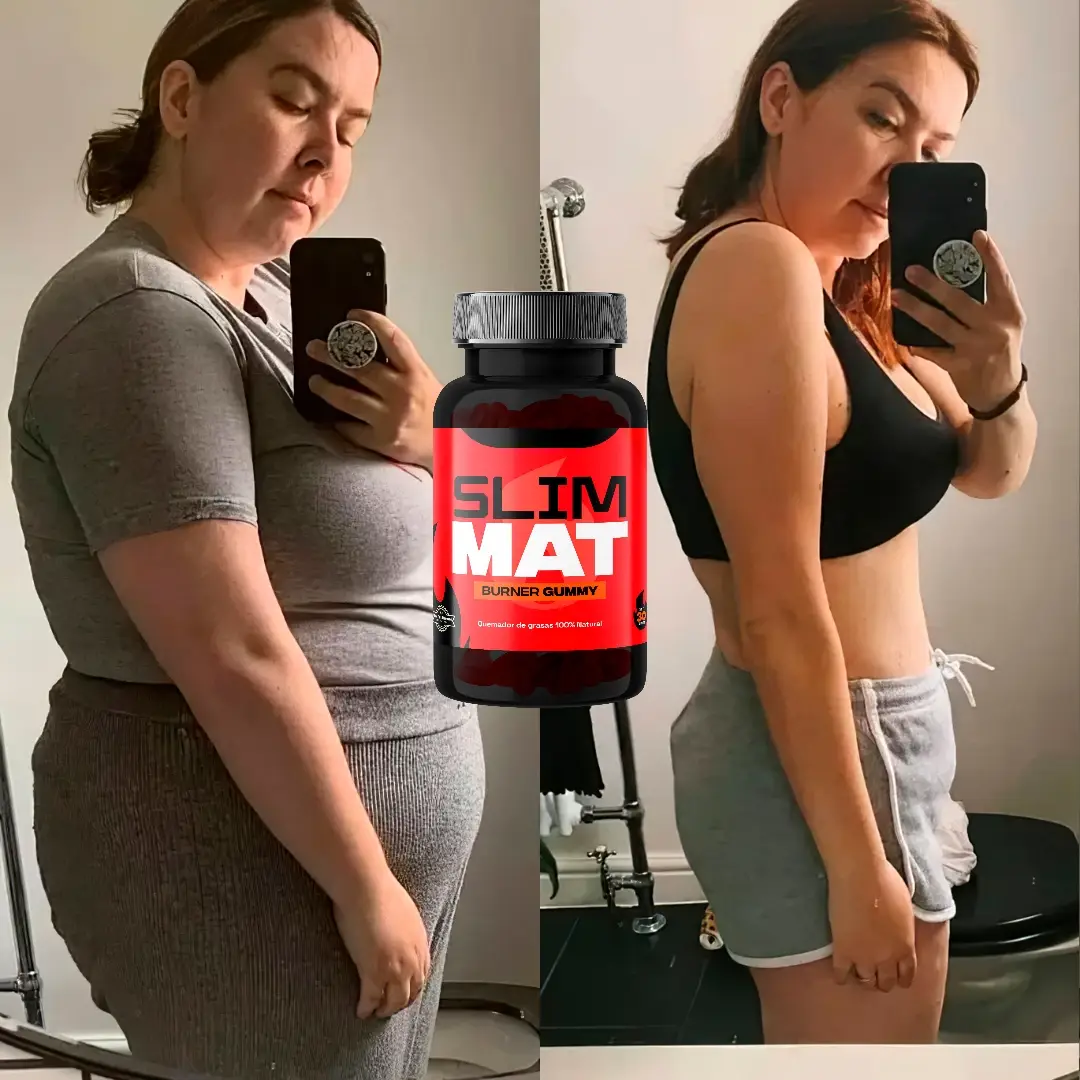 MyImage-1750295278-00