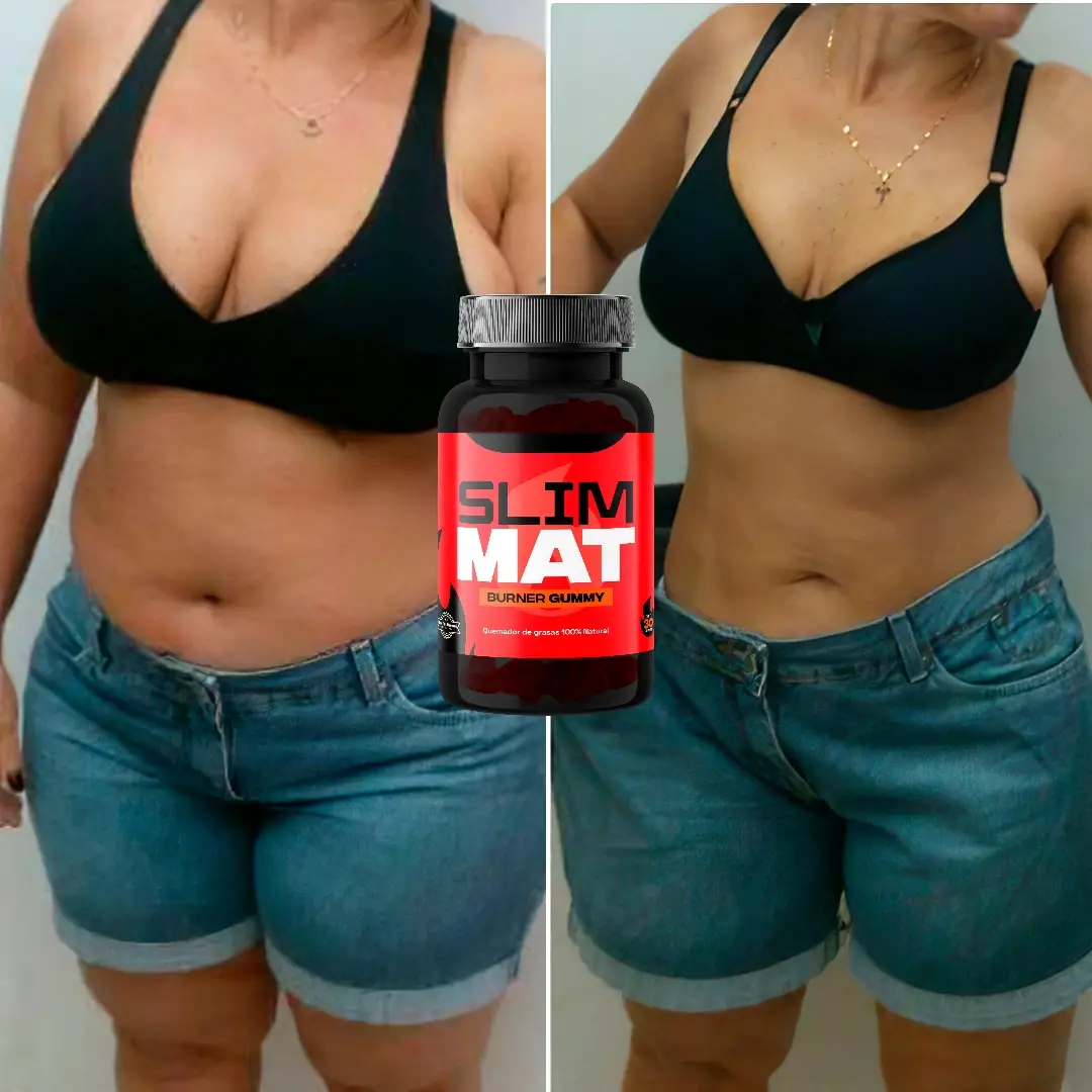 MyImage-1750295372-00