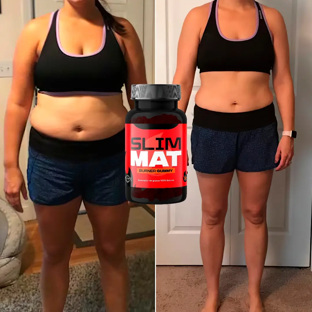 MyImage-1750295636-00