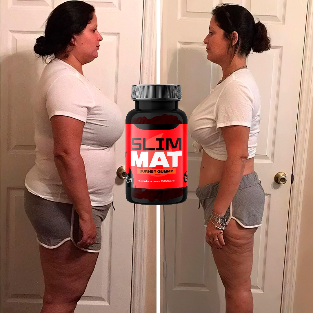 MyImage-1750295810-00